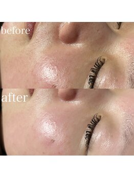 薫風/フェイシャルワックス/30代