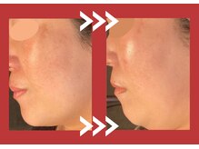 サロン デ ミロ(Salon de Miro)/BeforeAfter多数！ブログへGO♪