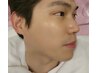 ★韓俳優肌作りフルコース→顔全体脱3回照射/セラピール/アクアピール吸引付
