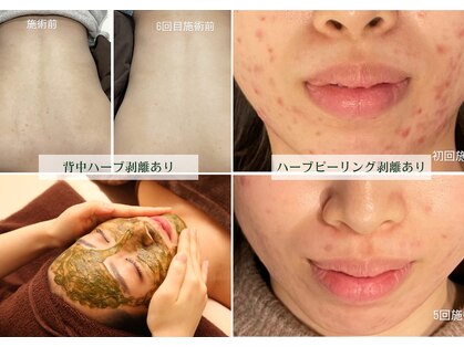 スマイルビューティラボ(Smile Beauty lab.)の写真