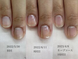 自爪育成→キープコース
