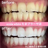 エクシアホワイトニング たまプラーザ店