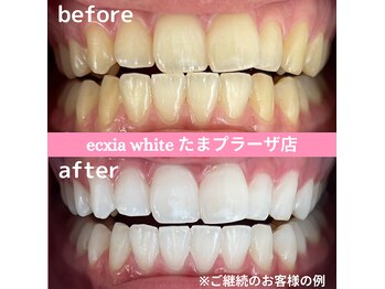 エクシアホワイトニング たまプラーザ店
