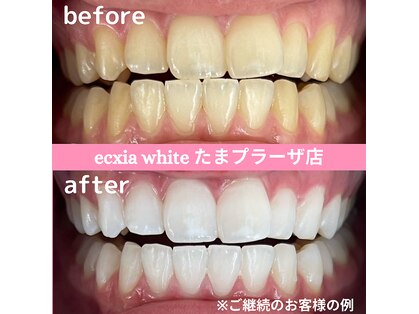 エクシアホワイトニング たまプラーザ店の写真