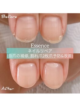 エッセンス (Essence)/割れ欠け2枚爪の予防＋育成に◎