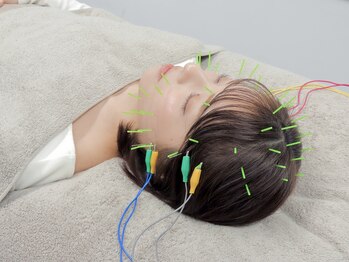 ハリカ 大阪心斎橋店(HARIKA)/ブライダル前に美容鍼×小顔矯正