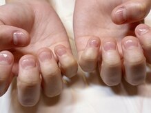 いろこびん 盛岡フェザン店(irokobin)/美爪育成