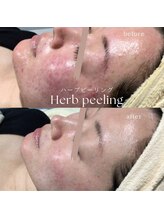 fallon beauty　痩身/フェイシャル/フェム・オムケア/アロマ/ボディケア/国産ハーブピーリング