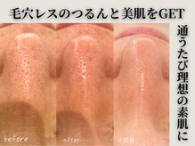 【本格診断】16タイプの肌診断で肌悩みの正しい原因がわかる！