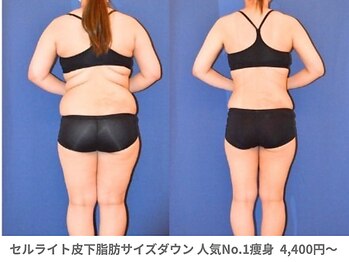 アンシャンテ 芦屋店/医師監修痩身