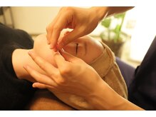 甲陽園鍼灸わたぐも/ヒト幹細胞培養液導入