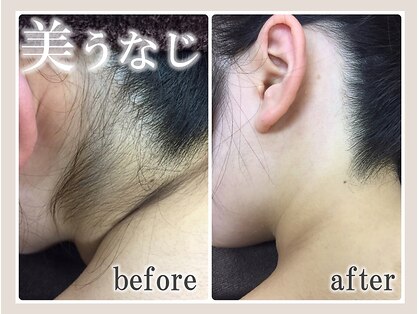 美肌脱毛専門店 パールプラス 新潟店(pearlplus)の写真