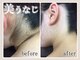 美肌脱毛専門店 パールプラス 新潟店(pearlplus)の写真