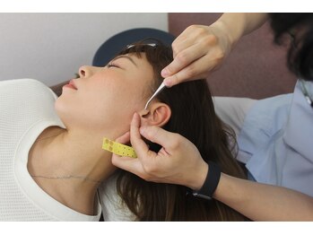 同心整体院/耳ツボ施術風景