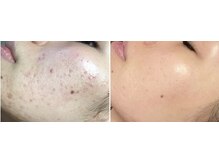 トータルビューティーサロン 肌屋(Total Beauty Salon)の雰囲気（フラクセル、ハーブピーリング、改善プログラム、様々アプローチ）