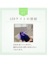 ホワイトニングショップ 奈良香芝店(Whitening shop)/セルフホワイトニング手順7