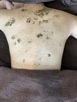 アノネ(Anone.)/背中ハーブ入れ込み中...