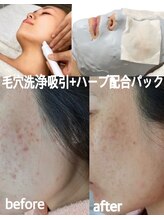 シェリー(Cheri)/毛穴洗浄+水光配合パック