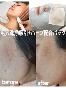 シェリー(Cheri)/毛穴洗浄+水光配合パック