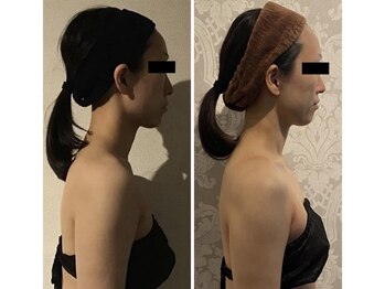 小顔フェイスラボ 伊勢店(小顔FaceLabo.)/◆小顔&整体コルギで姿勢改善◆