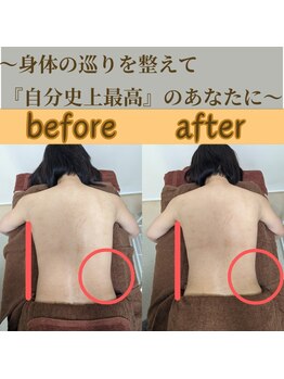 めぐりねこ/リンパ/痩身/小顔/たるみケア