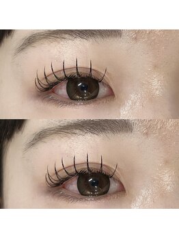 タムタム 市川(tamtam)/フラット100本