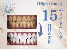 ラフ(LAUGH)/【審・美・白】 ホワイトニング