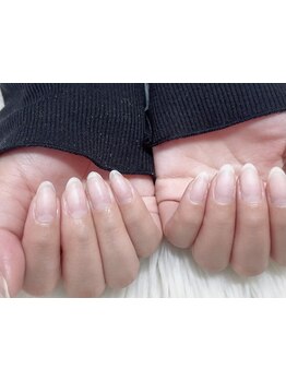 爪の悩みを解消できる（ケア含む）