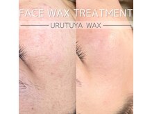 リア(Li'a.)の雰囲気（当店人気No. 1のフェイシャルWaxになっております☆）