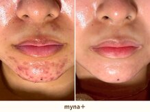 マイナプラ 表参道(myna+)/原因不明のお悩みもご相談下さい