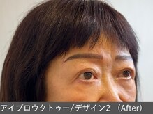 オアシスラグーン(OASIS LAGOON)/アイブロウデザイン2（after）
