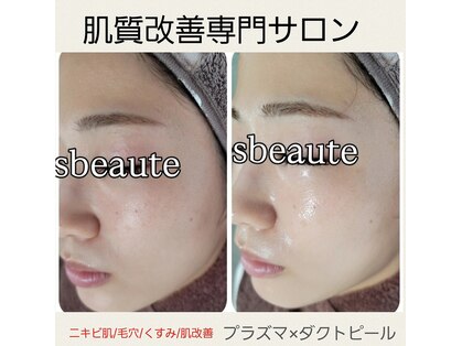 エスボーテ(sbeaute)の写真