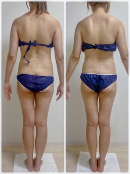 エヌラボ(N.LABO)/痩身