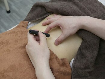 天華康整体院の写真/≪温経療法≫でじんわりと温めながら冷え改善/代謝アップ!冷えによる辛さも気持ちよく和らぐ癒しのひと時。