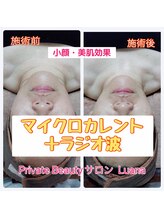 ルアナ(Luana)/マイクロカレント＋ラジオ波