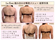 ラエッセ(La Esse)/ブライダルエステ