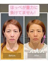 サリエ(S'allier)/ビフォーアフター