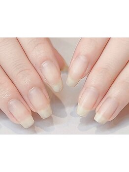 爪の悩みを解消できる（ケア含む）