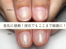 ルチル(Le chill)の雰囲気(爪、以外と人に見られてます。隠す生活はもう辞めませんか?)