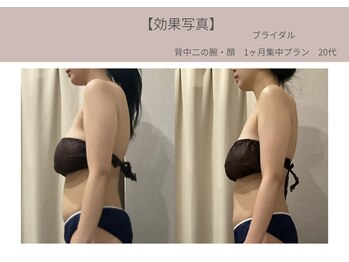 ミライ 福岡筑紫野店(mirai)/360度美しさUP☆ライン出し◎