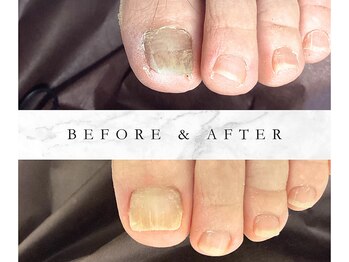 足先の血行もよくなります