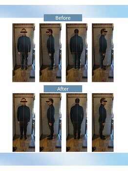 守谷やまゆり鍼灸整骨院/ビフォーアフター