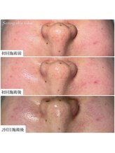 サラン スキンサロン(Sarang skin salon)/
