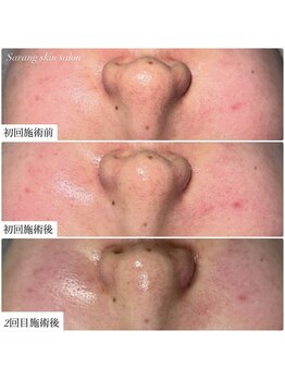 サラン スキンサロン(Sarang skin salon)/