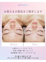 ソルナティ 伊勢原(SOLNATY)/デコルテから整える立体小顔矯正