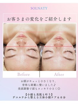 ソルナティ 伊勢原(SOLNATY)/デコルテから整える立体小顔矯正