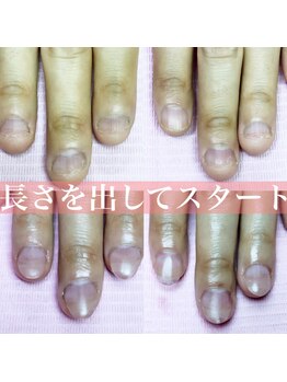 イリスネイル(IRIS NAIL)/