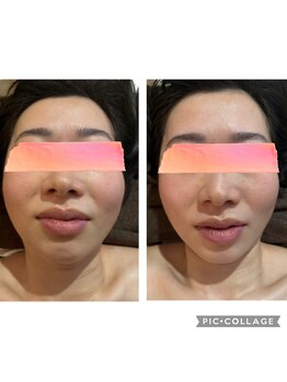 キサラ(Kisara)/小顔整体+ヘッドマッサージ