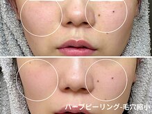 アンナビューティ 六本木 乃木坂店(Anna Beauty)の雰囲気(結果重視の肌質改善サロン・お客様のお悩み別メニューをご提案)