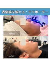 癒える(ielu)/テラボーラー ★小顔スッキリ！